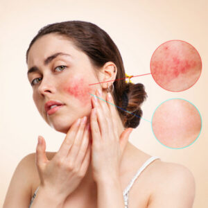 Skin Care